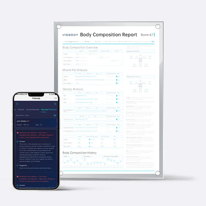 Visbody-S30_Report_01